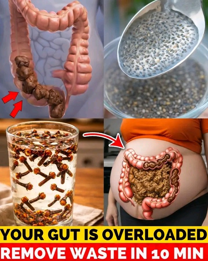 Drink Just 1 Glass to Cleanse Your Entire Colon in 10 Minutes. This Starts a Full Colon Clean-Out-of Wedlock