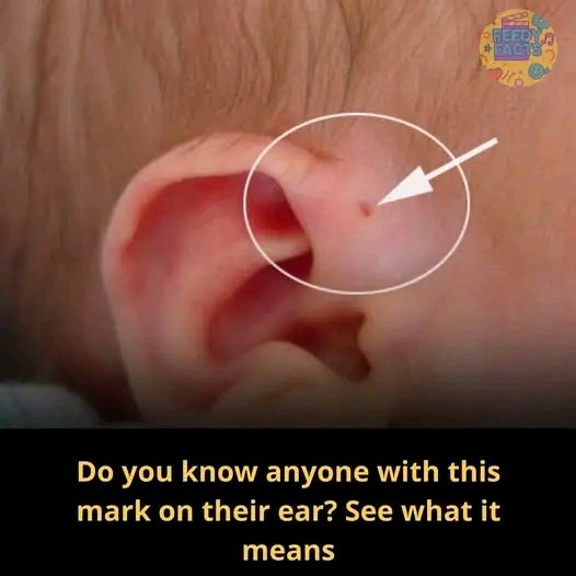 Do you know anyone with this mark on their ear? See what it means