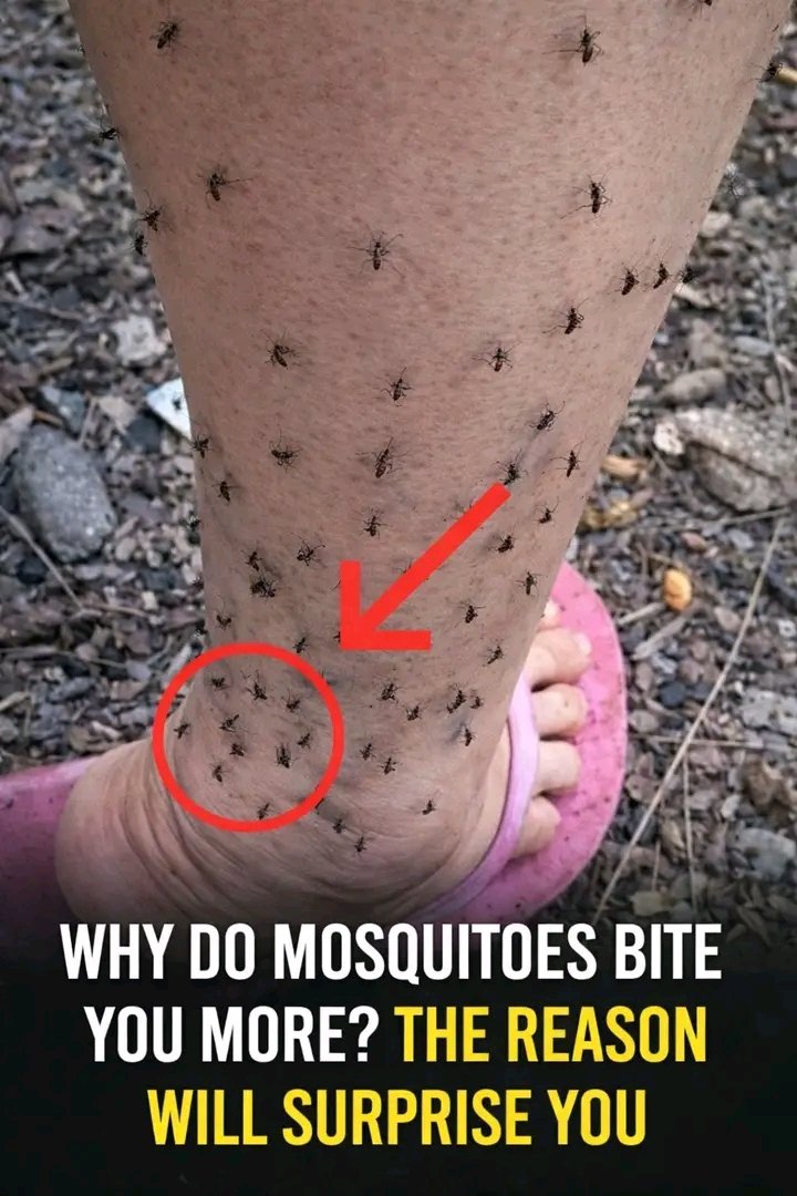 Why do mosquitoes only bite you? The reason will surprise you… See more