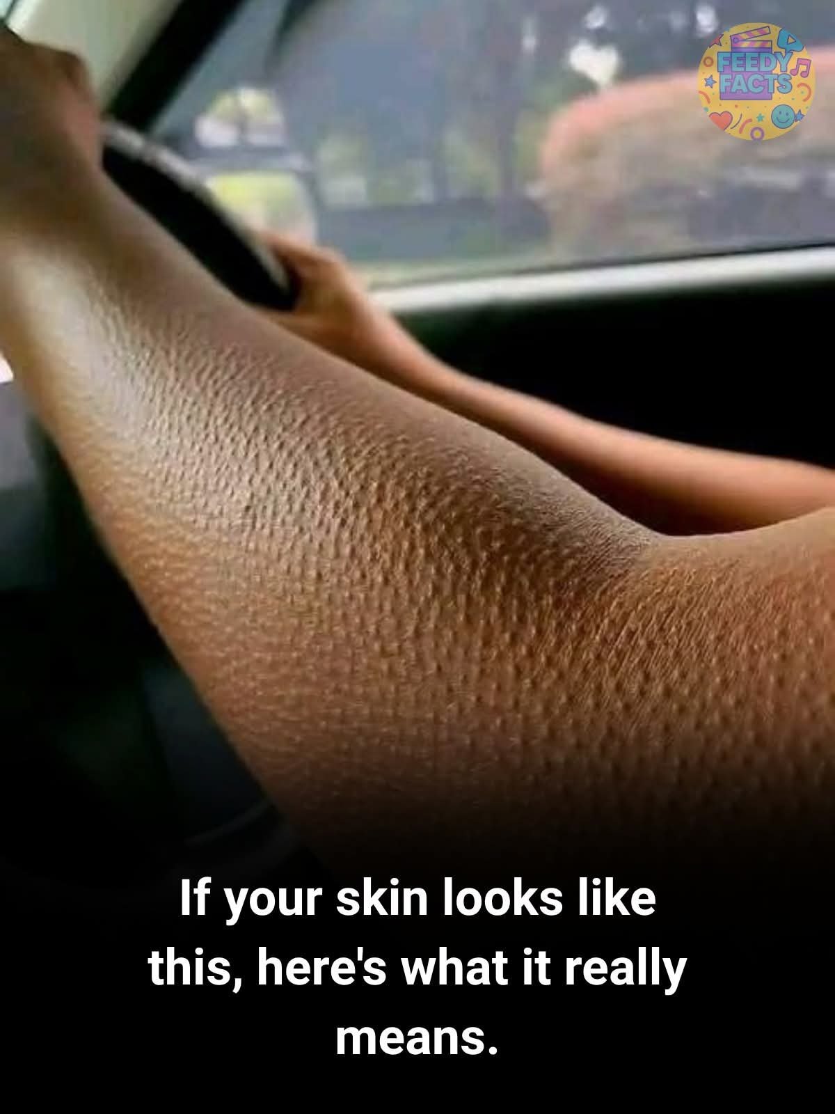 If Your Skin Looks Like This — Here’s What It Might Really Means?