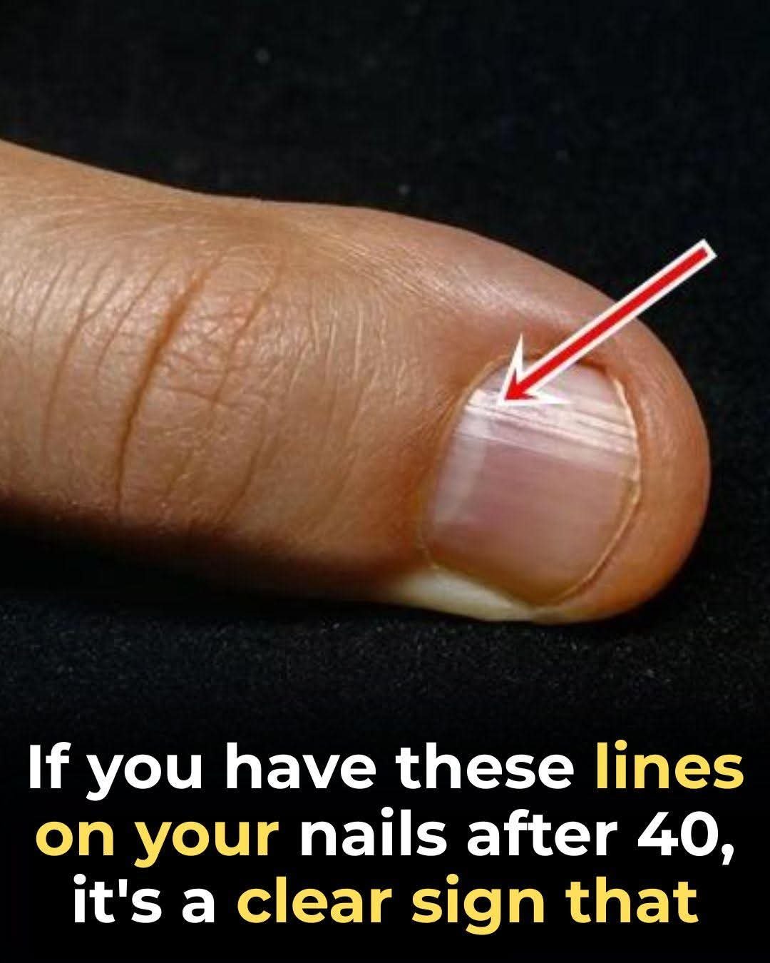 Top Foods to Strengthen Your Nails After 40.