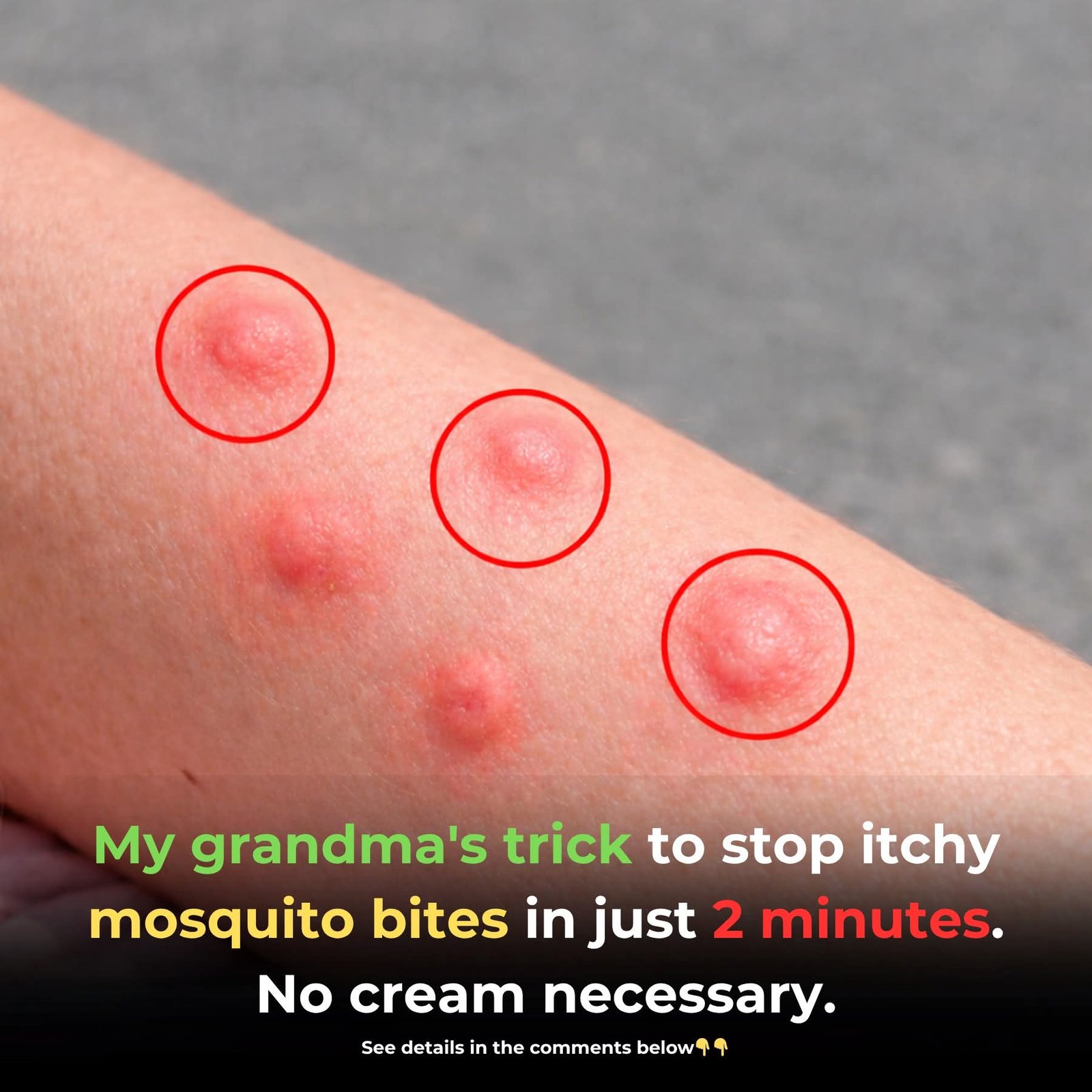 My Grandma’s Trick to Stop Itchy Mosquito Bites in Just 2 Minutes
