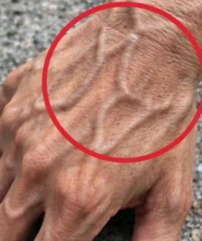 If you have visible veins, it means you are… See more