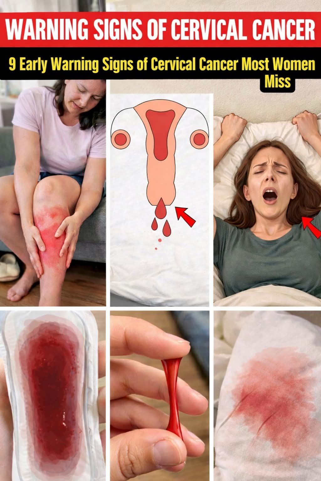 9 early cervical cancer warning signs most women ignore… until it’s too late , Could you recognize them in time? One symptom is often missed…