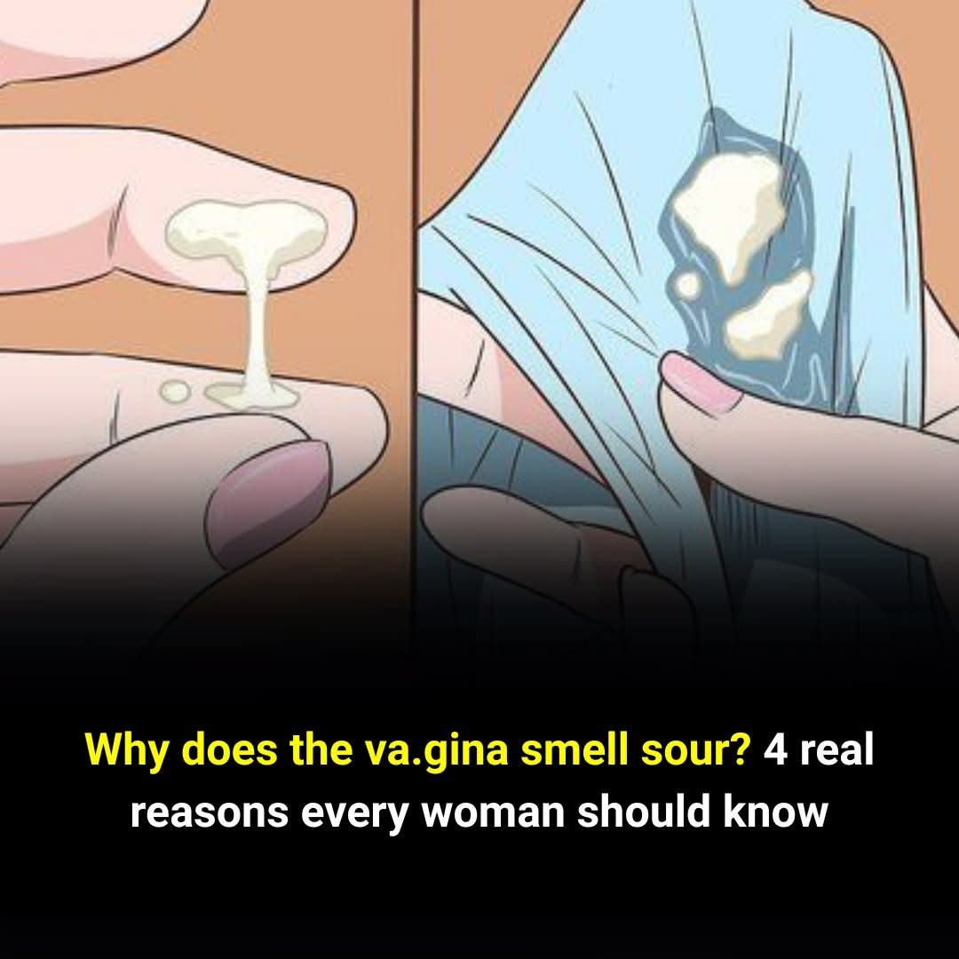 A Sour Vag:inal Smell — What Does It Mean? 4 Causes Every Woman Should Know