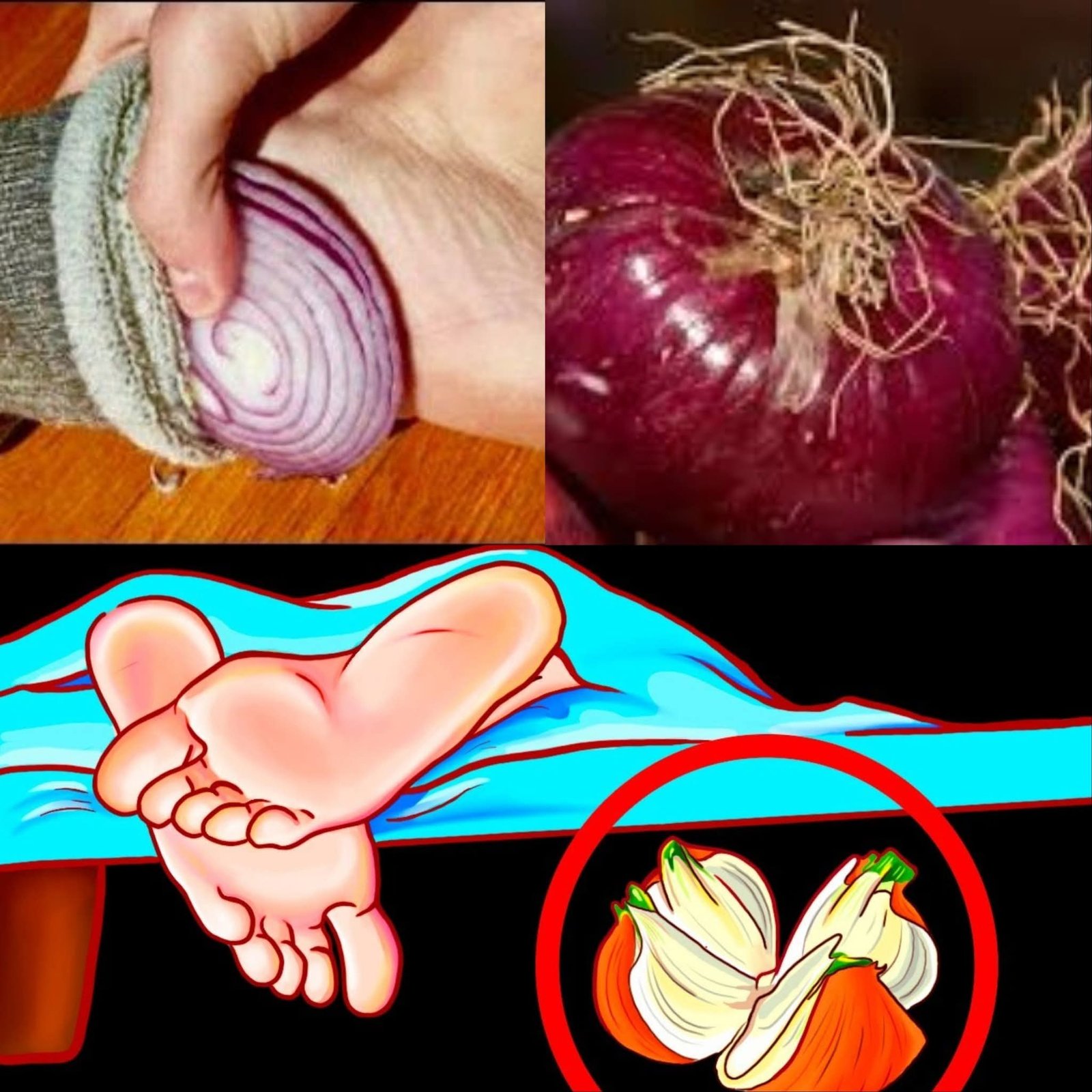 What happens when you sleep with onion in your socks Must express something to keep getting my recipes 🙏 Full recipe in the first comment 💬👀