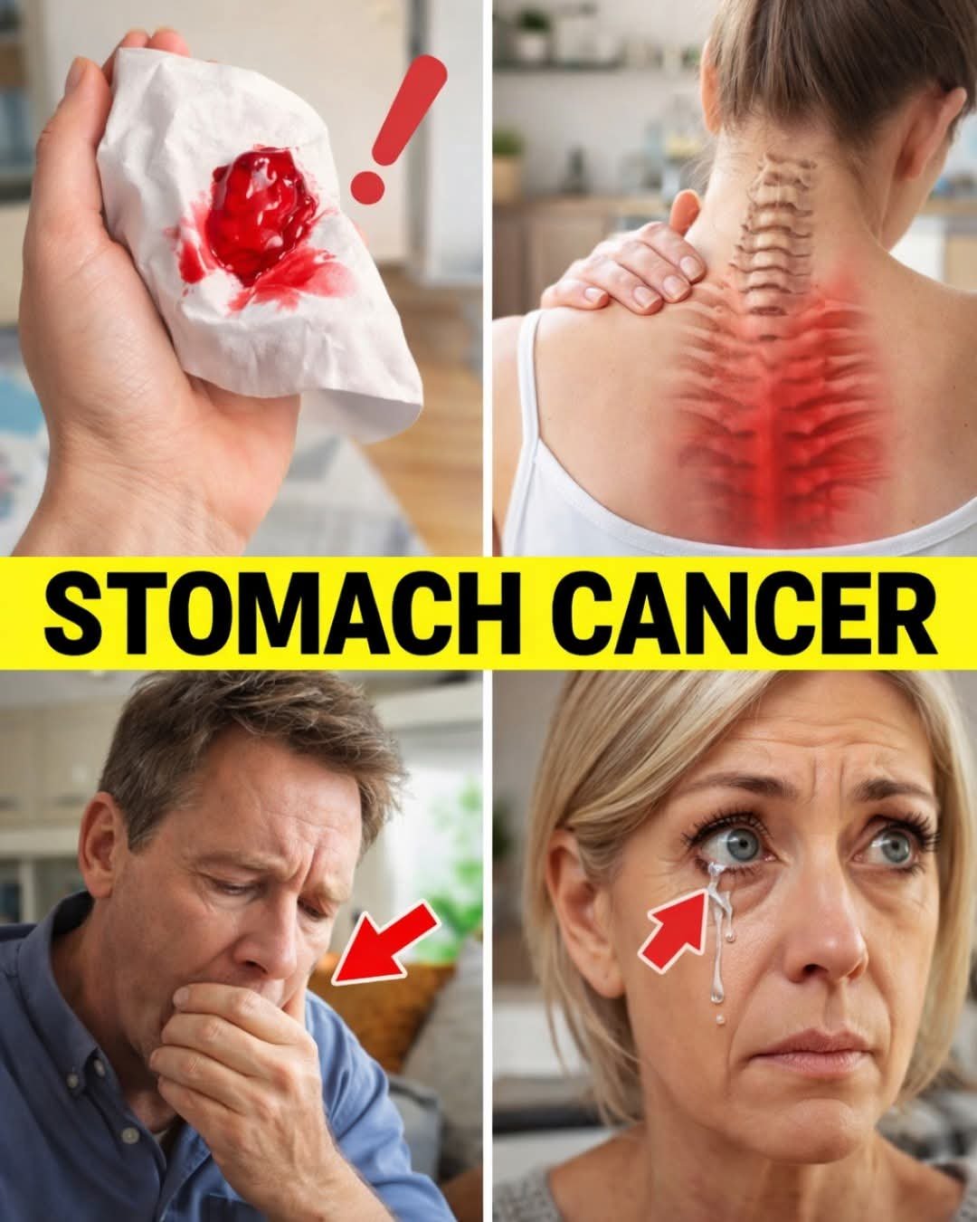 ⚠️ 8 Strange Signs of Stomach Cancer (Gastric Cancer)