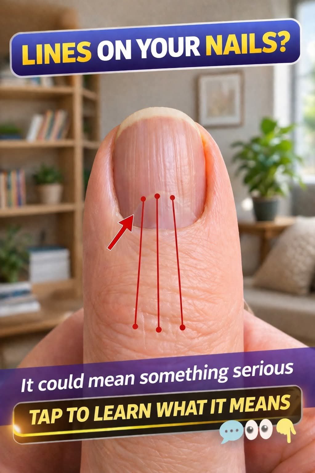 If you have lines on your nails, it means you have …See more