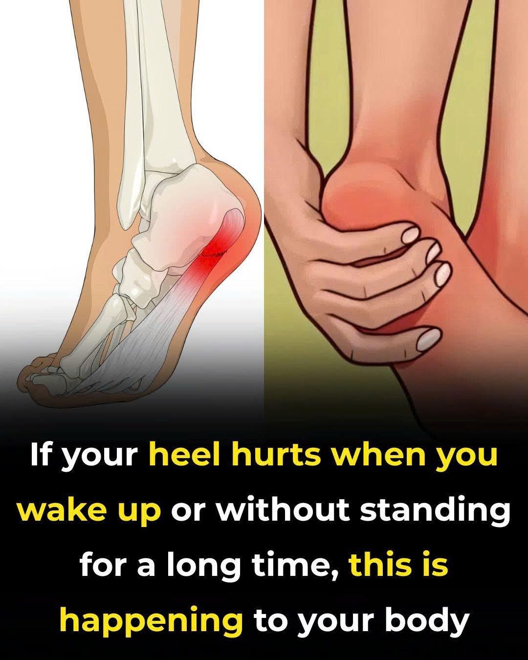 Morning Heel Pain Is More Common Than You Think — Here’s Why